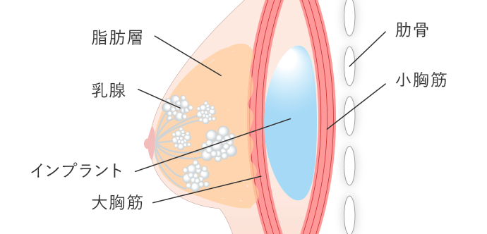 大胸筋下法イメージ